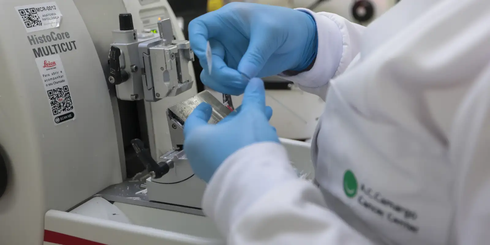 SUS inclui nova terapia para pacientes adultos com leucemia mieloide